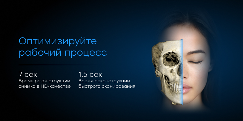 RAY Quantum 10×10 с цефалостатом, быстрое сканирование Frame 9.jpg